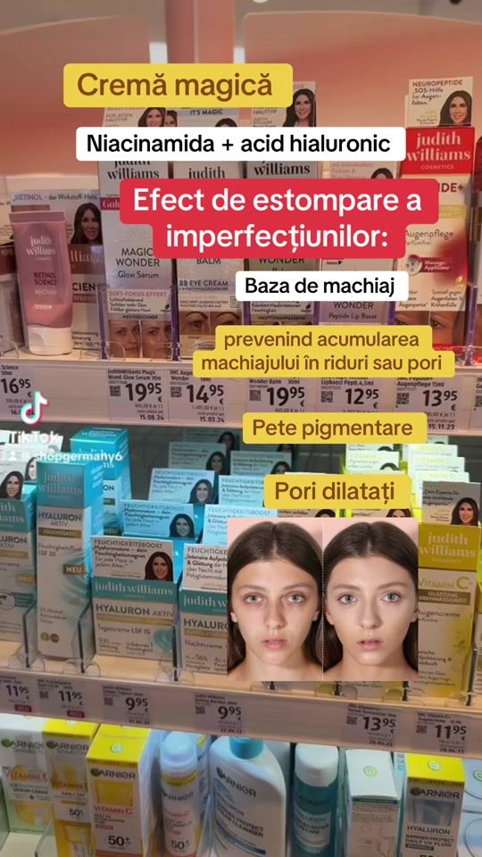 TikTok video thumbnail by shopgermany6