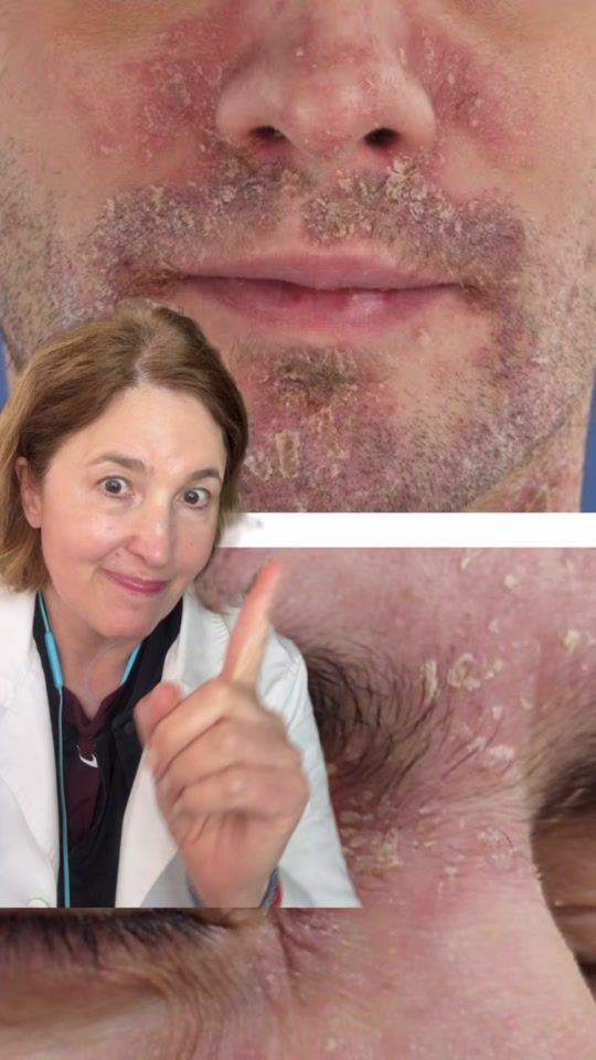 TikTok video thumbnail by matufarma