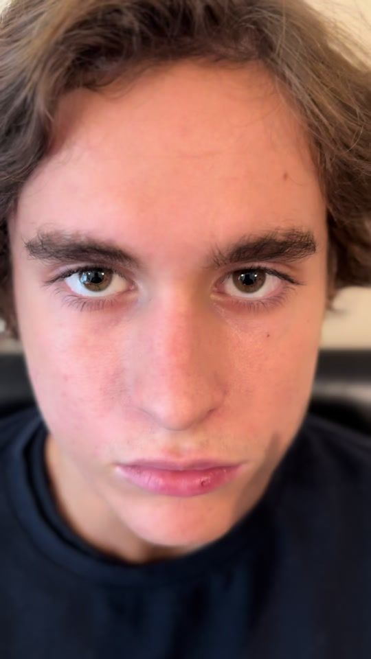 TikTok video thumbnail by theringsidedoc