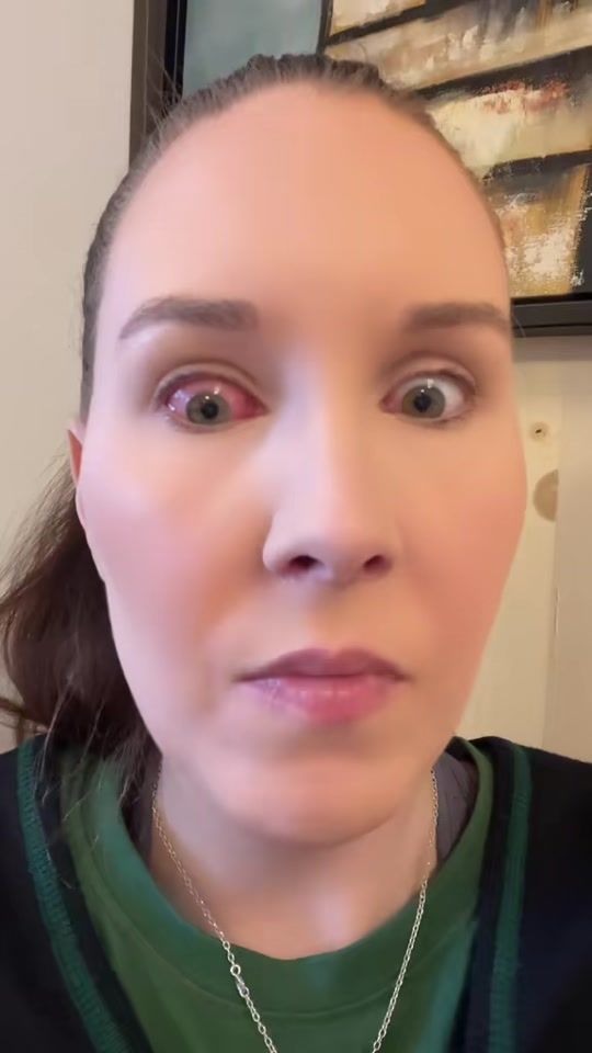TikTok video thumbnail by kattepusz