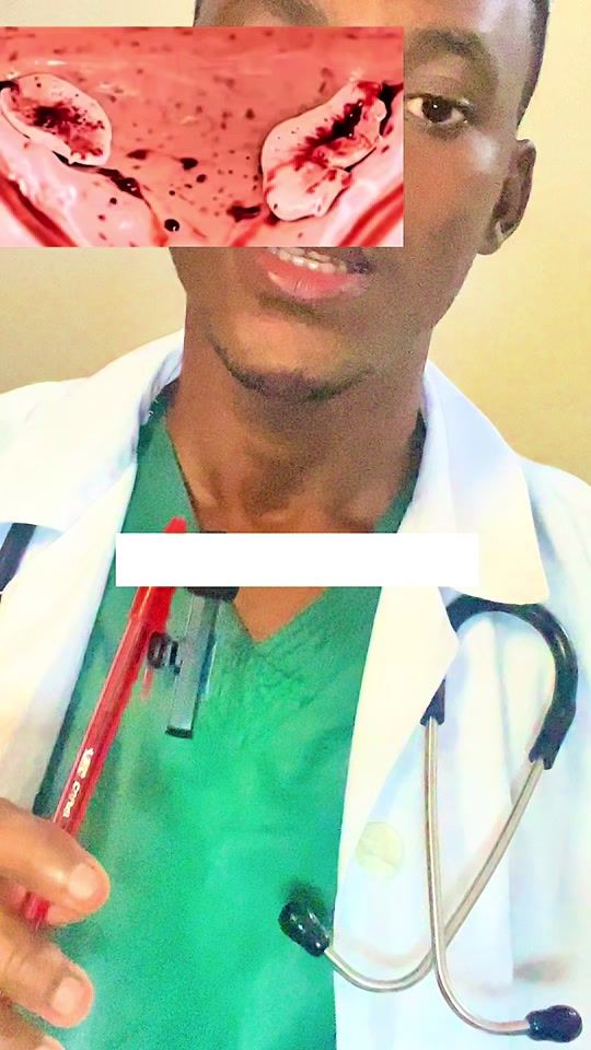 TikTok video thumbnail by docteurmedard7