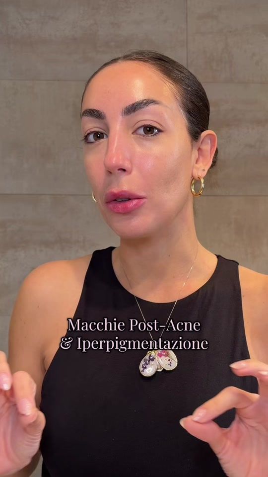TikTok video thumbnail by chiara.parente