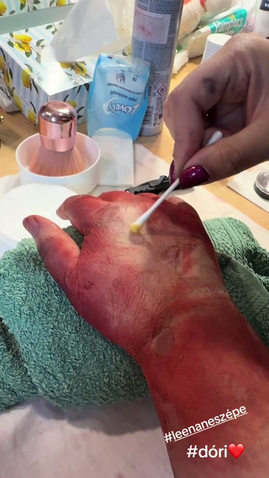 TikTok video thumbnail by balazsandi