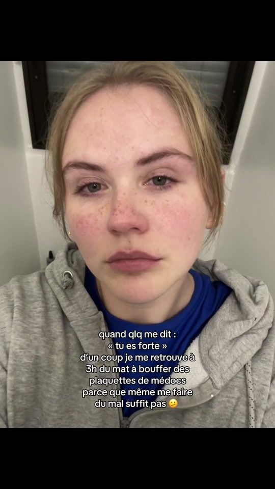 TikTok video thumbnail by keikxx