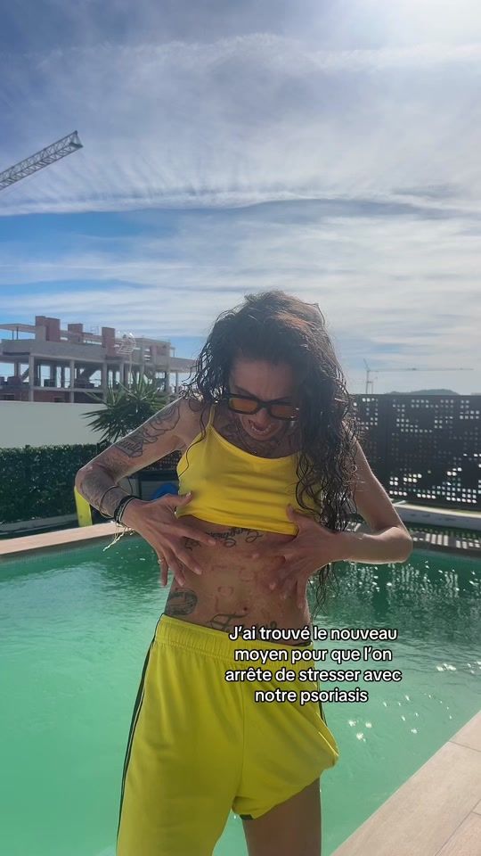 TikTok video thumbnail by lyla_psoriasistyle