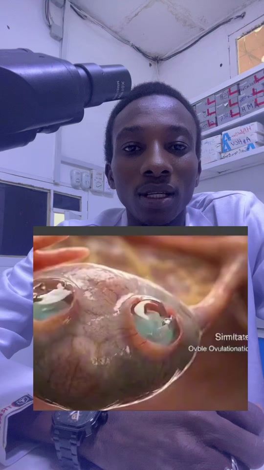 TikTok video thumbnail by abakar.off