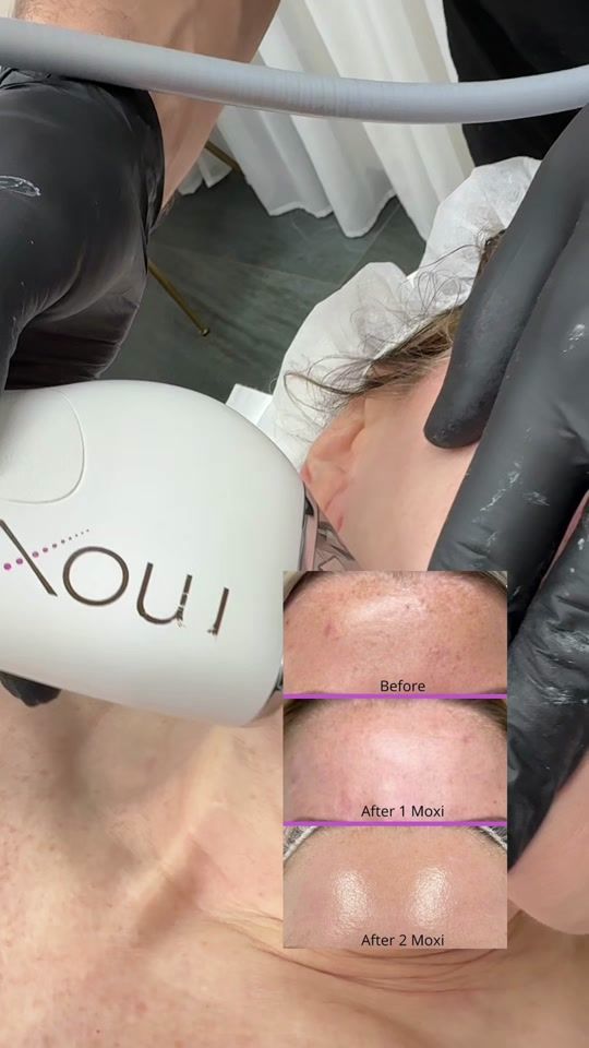 TikTok video thumbnail by sk.clinic