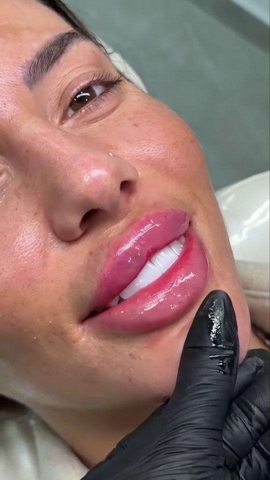 TikTok video thumbnail by dr.roxana.as