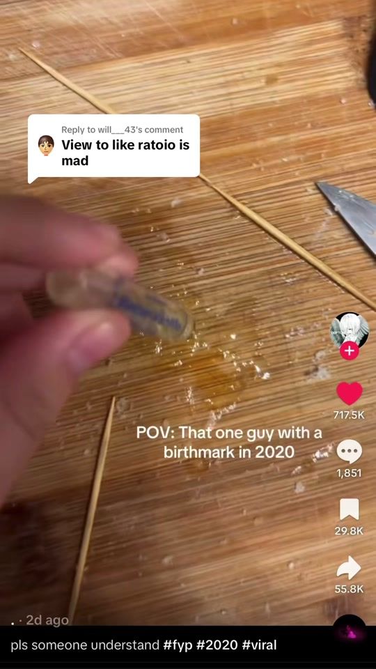 TikTok video thumbnail by robert.ferdos