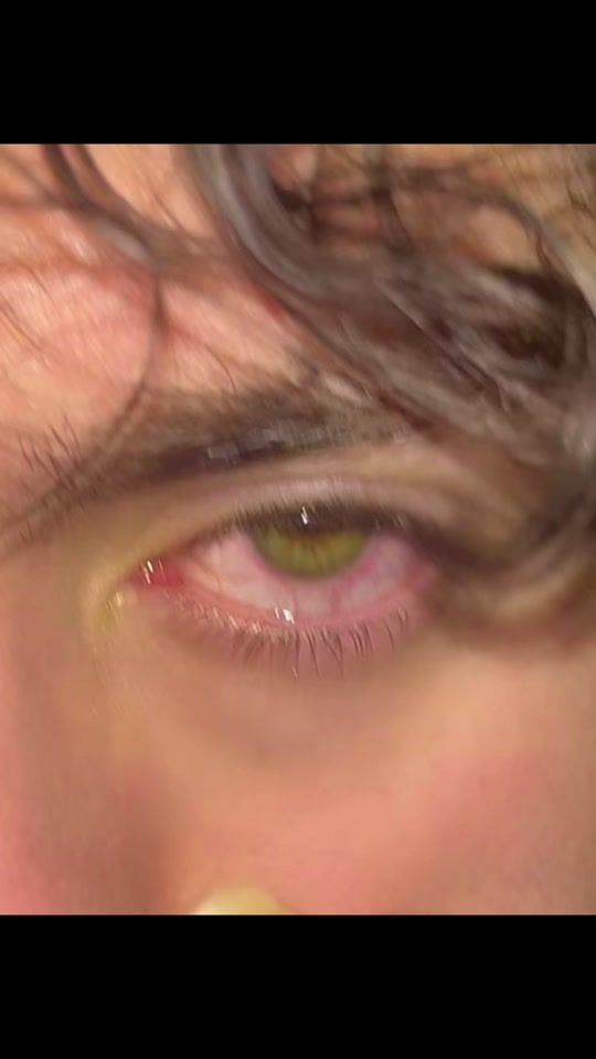 TikTok video thumbnail by ren.brrson