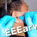 @theearwaxspecialist