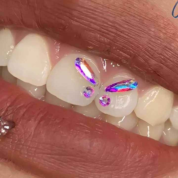 piercing.toothgems