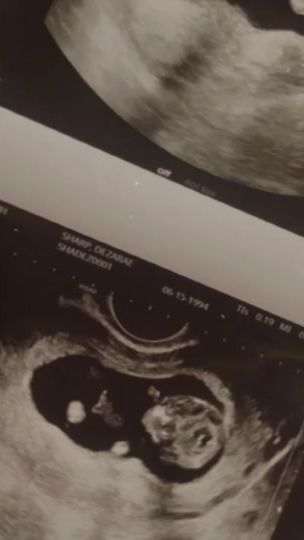 TikTok video thumbnail by mrbabyjk