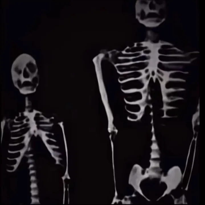@onlybonez