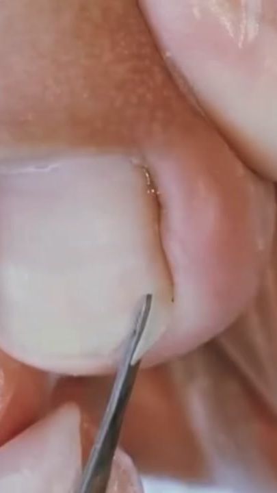 TikTok video thumbnail by toenailvipp