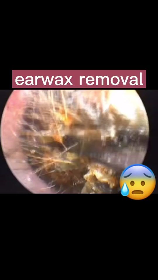 TikTok video thumbnail by lookrecap