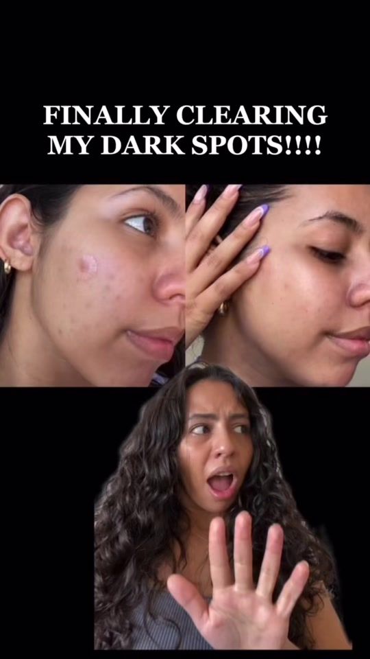 TikTok video thumbnail by hyperskin