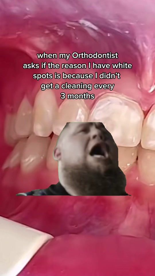 TikTok video thumbnail by jefferson_dental