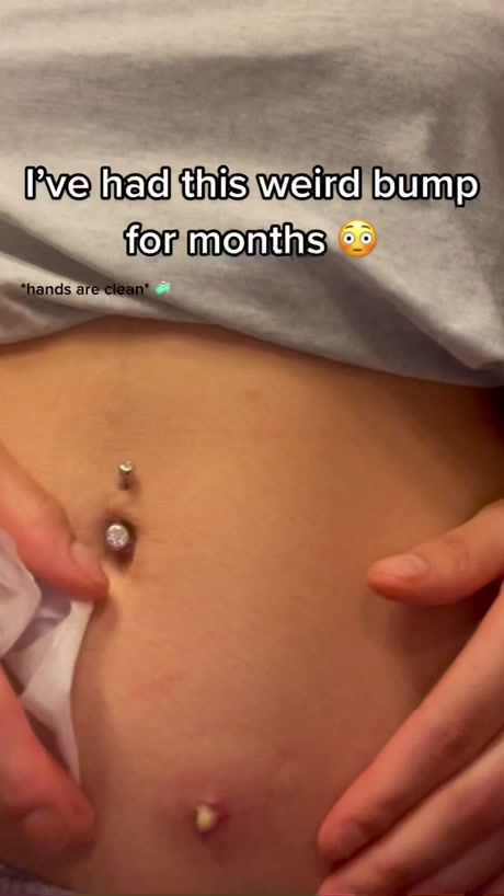 TikTok video thumbnail by chyreddthe1