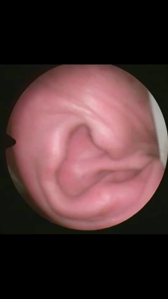 TikTok video thumbnail by doctor.sina