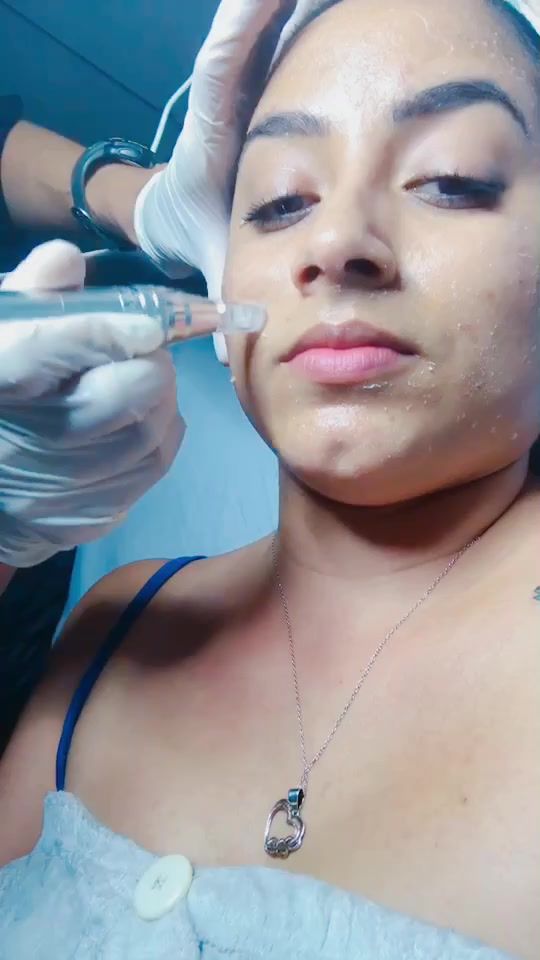 TikTok video thumbnail by lifeskinsoap