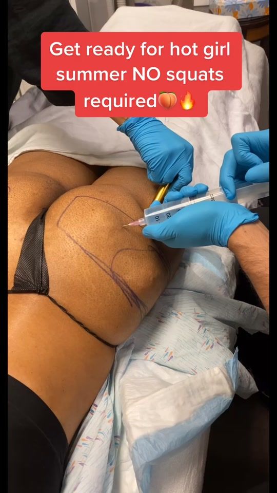 TikTok video thumbnail by realdrseattle