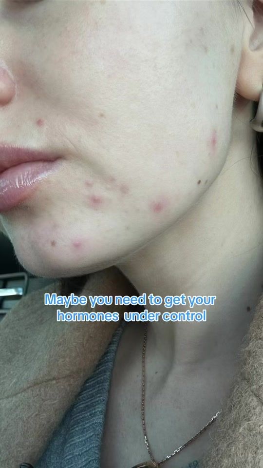 TikTok video thumbnail by clearstemskincare