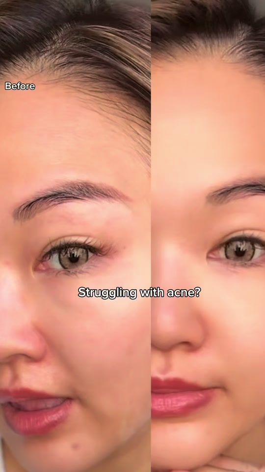 TikTok video thumbnail by athenanaa