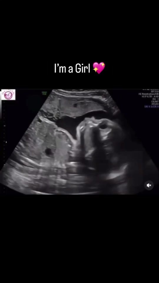 TikTok video thumbnail by peekaboobabyrgv