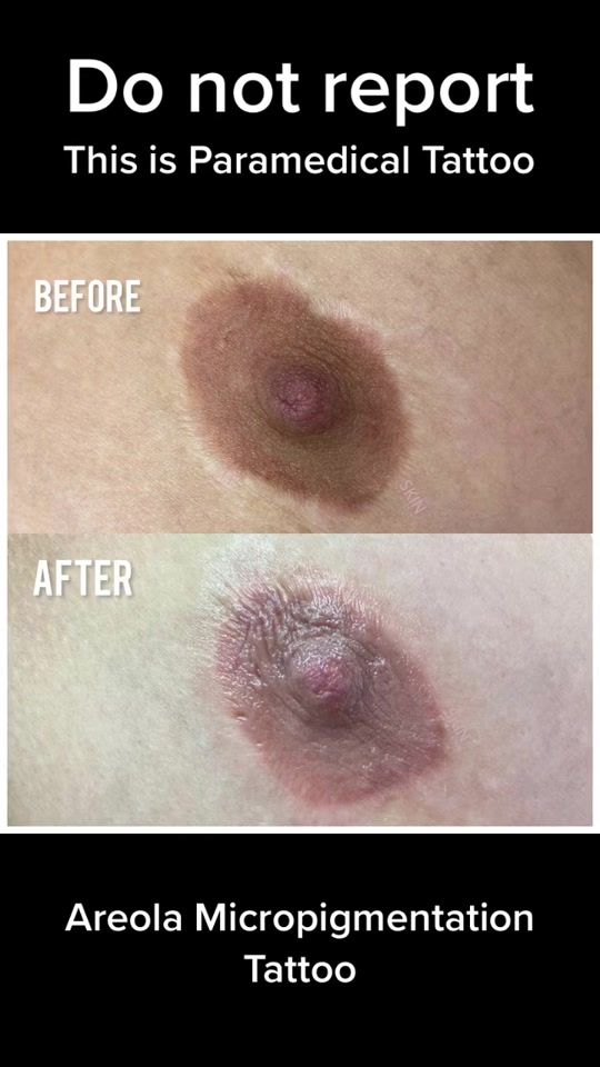 TikTok video thumbnail by skinbymissm