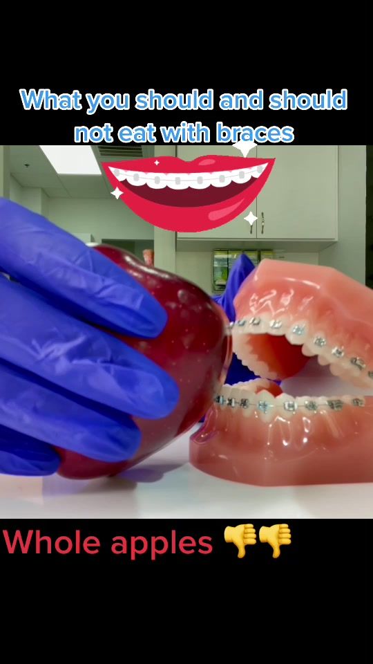 TikTok video thumbnail by opdsmiles