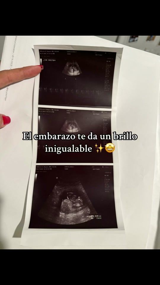 TikTok video thumbnail by analy_graciela23