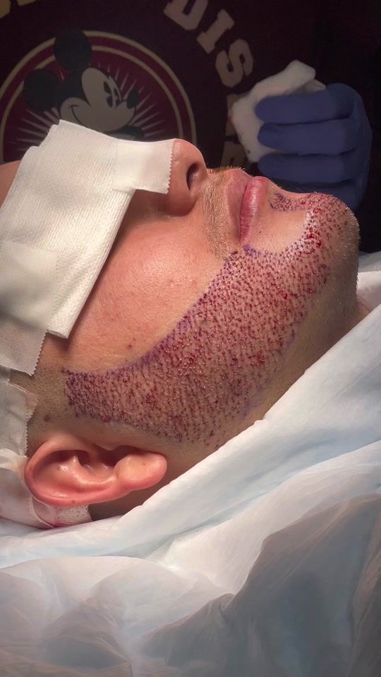 TikTok video thumbnail by care4hair.miami