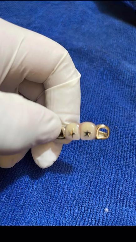TikTok video thumbnail by dental_el_superior_1