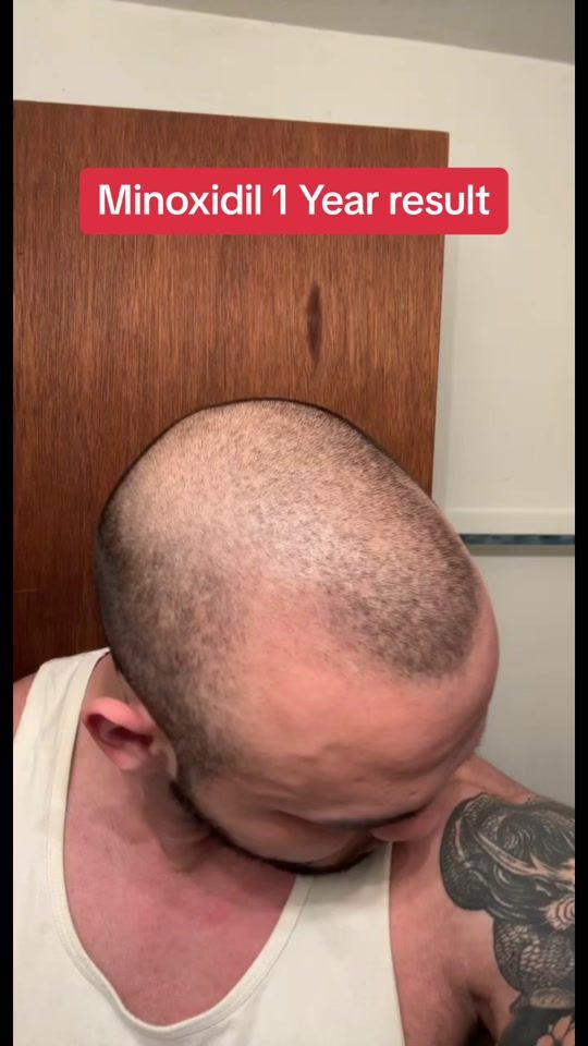 TikTok video thumbnail by davidonatuesday