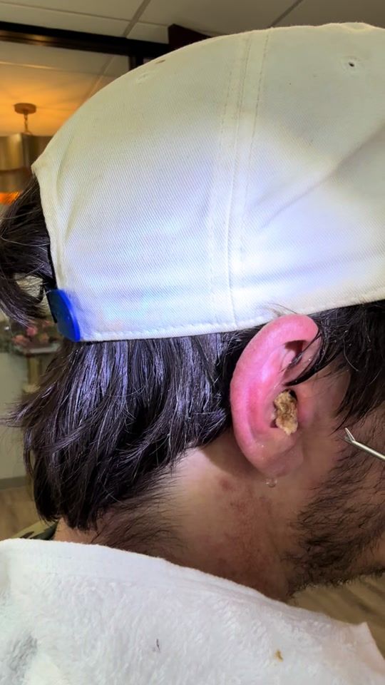 TikTok video thumbnail by doctorelly