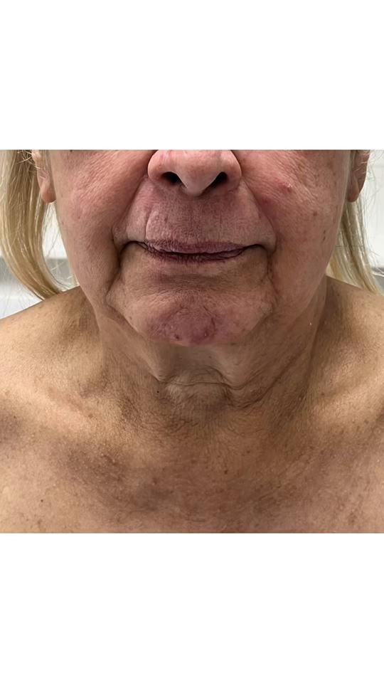 TikTok video thumbnail by dramarcelamolina