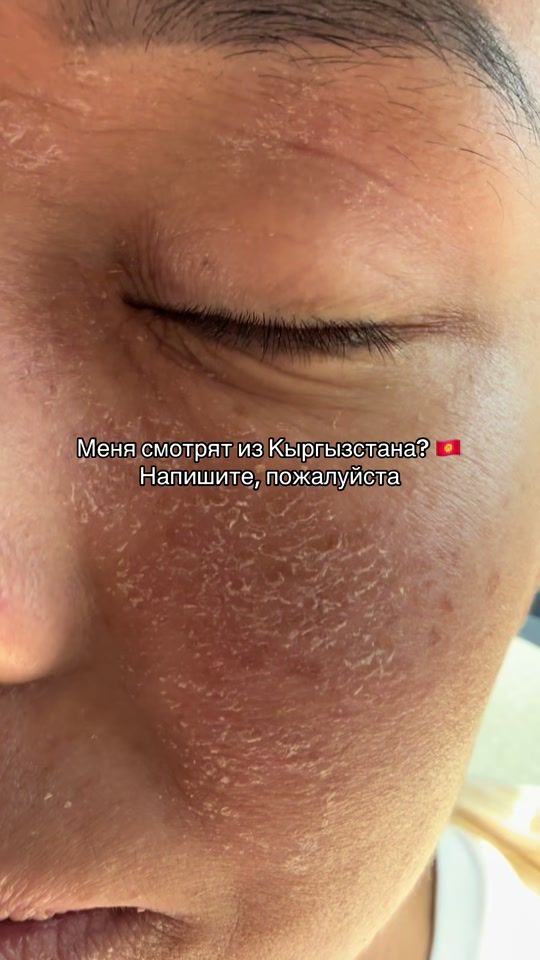 TikTok video thumbnail by gulztsw