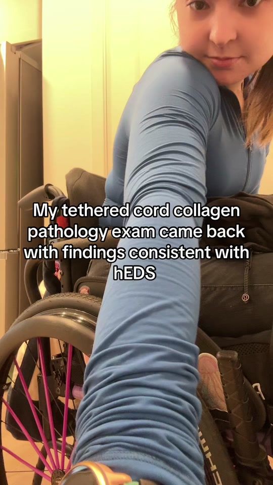 TikTok video thumbnail by ehlers.samlos