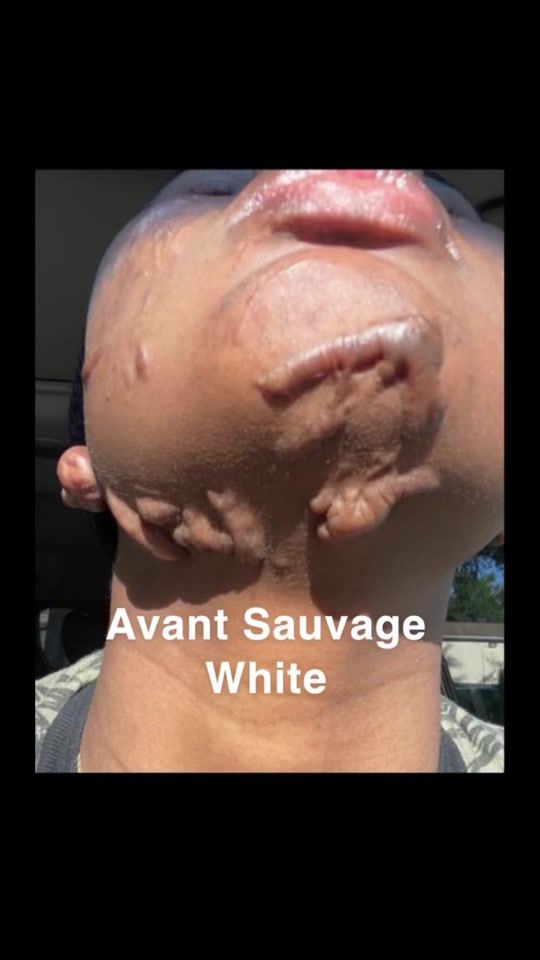 TikTok video thumbnail by sauvage_white_clinicllc