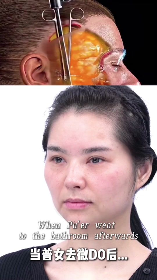 TikTok video thumbnail by dr.you08