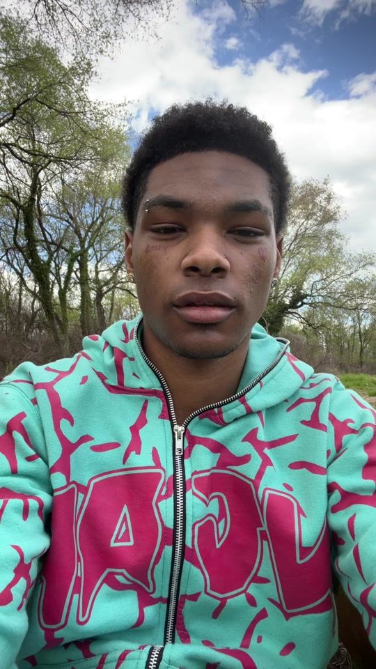 TikTok video thumbnail by xkidtrauma