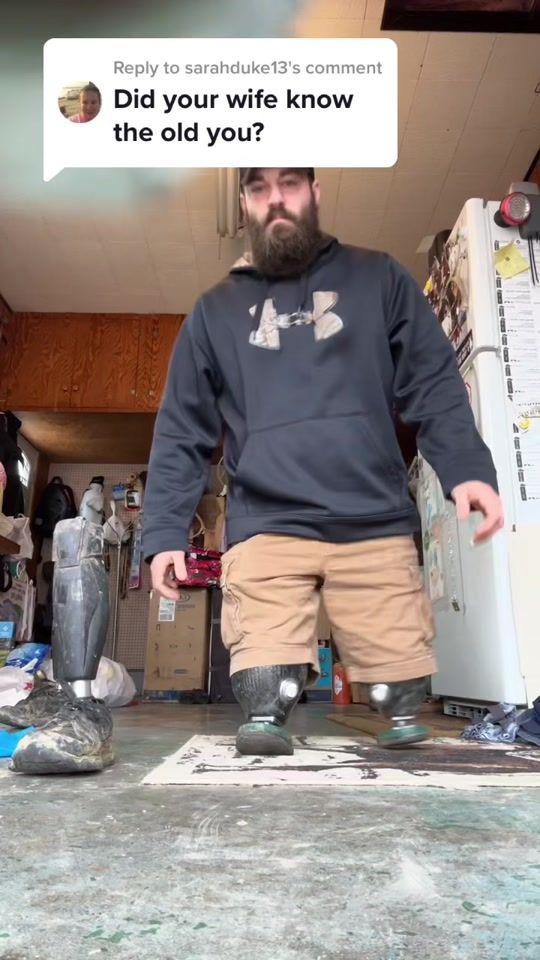 TikTok video thumbnail by limb_loss_boss