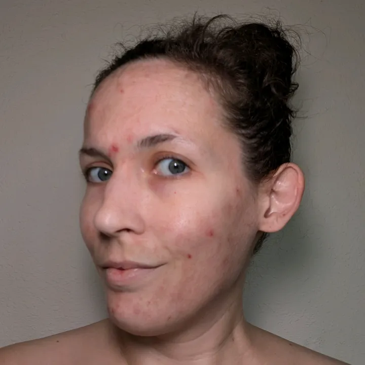 atrophicbeauty