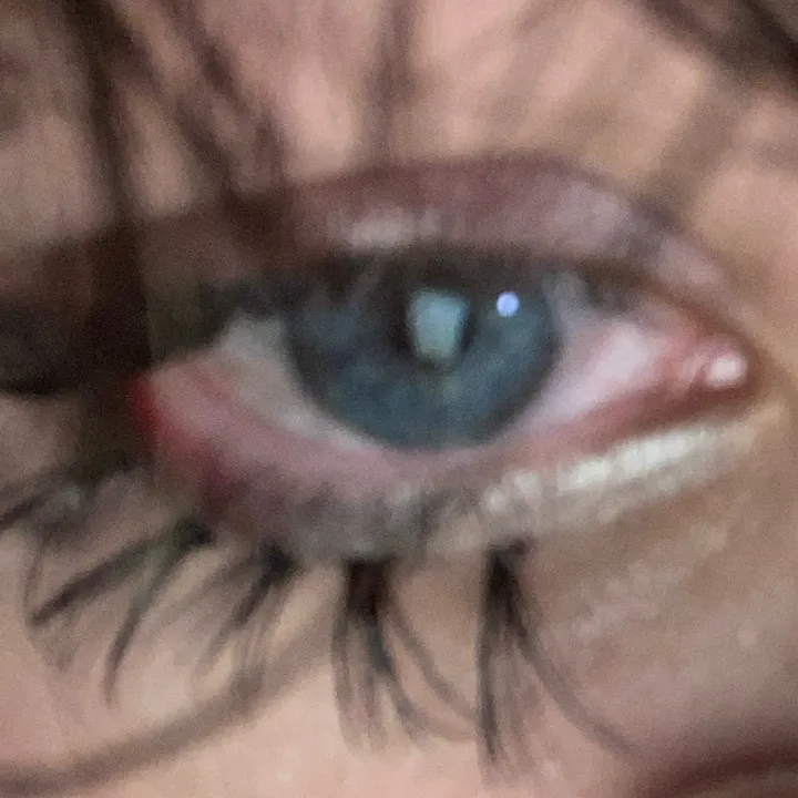 umi_bugs