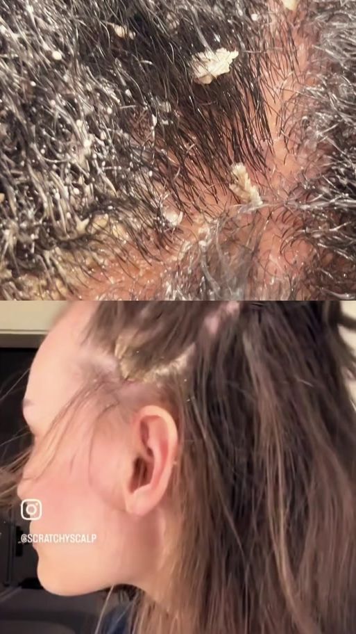 TikTok video thumbnail by headspabyguslene