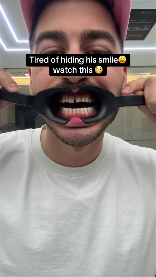 TikTok video thumbnail by topsmiles_drd