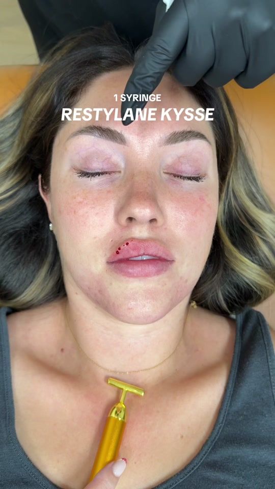 TikTok video thumbnail by estheticscenter