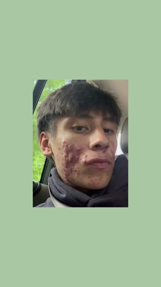 TikTok video thumbnail by fix.your.sh1t