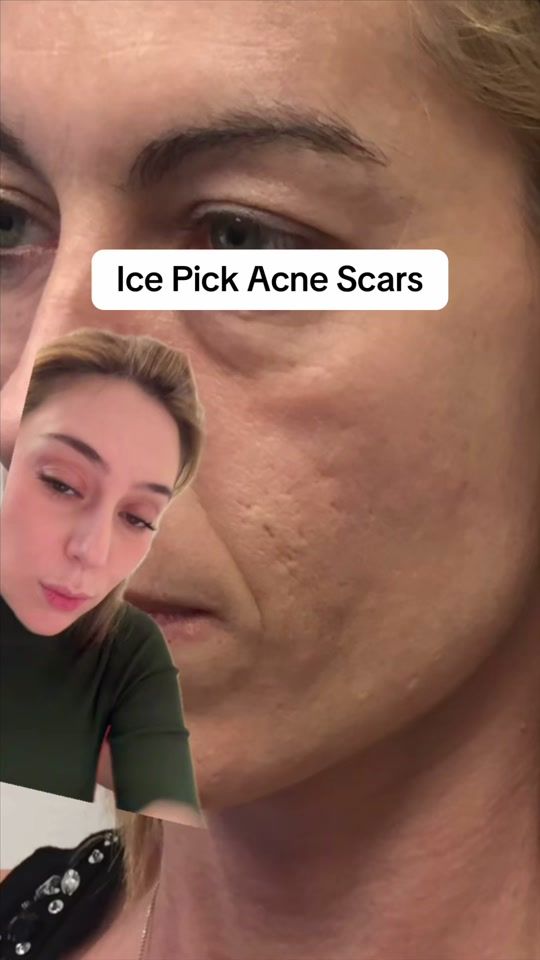 TikTok video thumbnail by shereeneidriss
